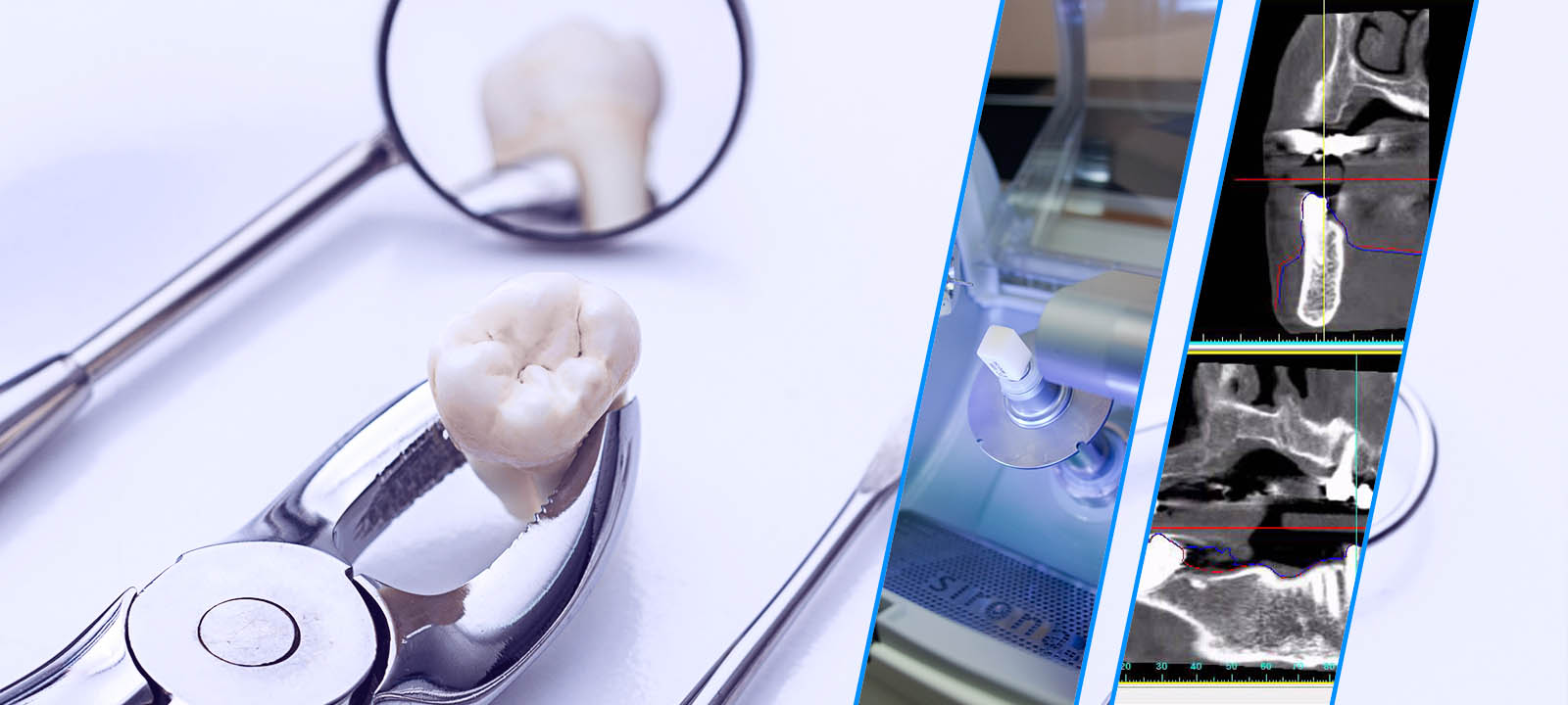 Εξοπλισμός τελευταίας τεχνολογίας